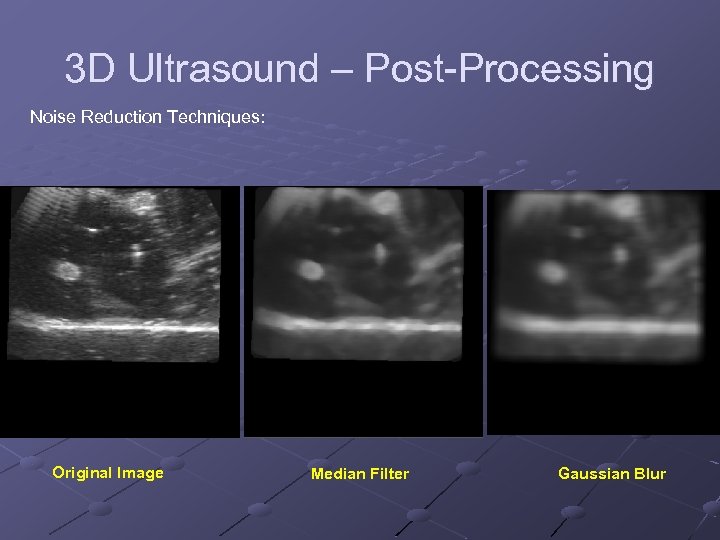 3 D Ultrasound – Post-Processing Noise Reduction Techniques: Original Image Median Filter Gaussian Blur