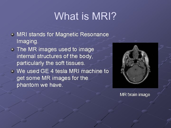 What is MRI? MRI stands for Magnetic Resonance Imaging. The MR images used to