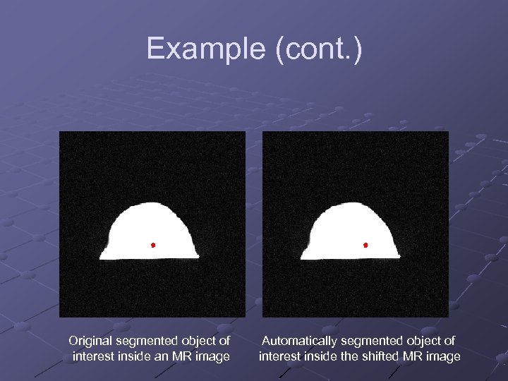 Example (cont. ) Original segmented object of interest inside an MR image Automatically segmented