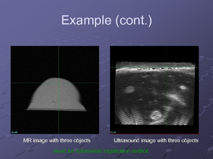 Example (cont. ) MR image with three objects Ultrasound image with three objects Need