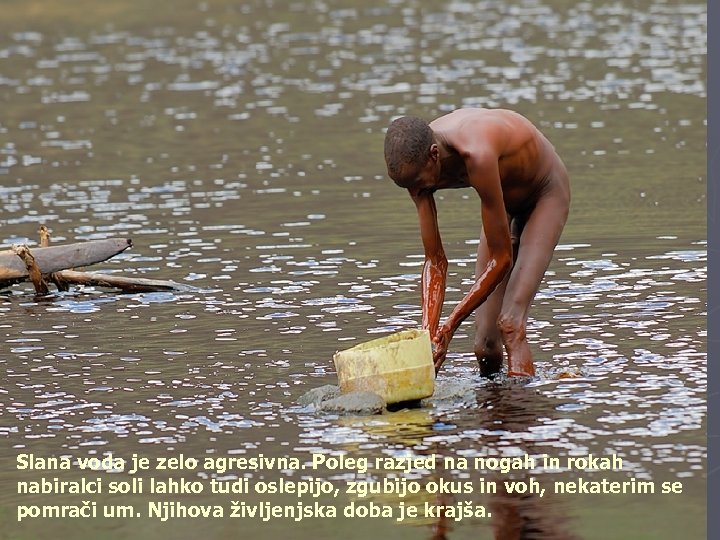 Slana voda je zelo agresivna. Poleg razjed na nogah in rokah nabiralci soli lahko