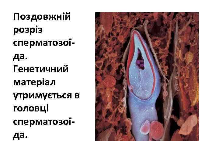 Поздовжній розріз сперматозоїда. Генетичний матеріал утримується в головці сперматозоїда. 