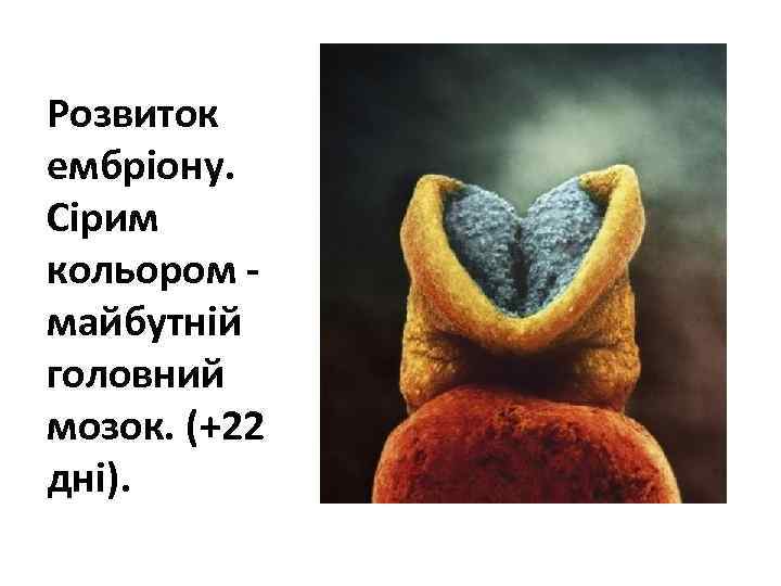 Розвиток ембріону. Сірим кольором майбутній головний мозок. (+22 дні). 