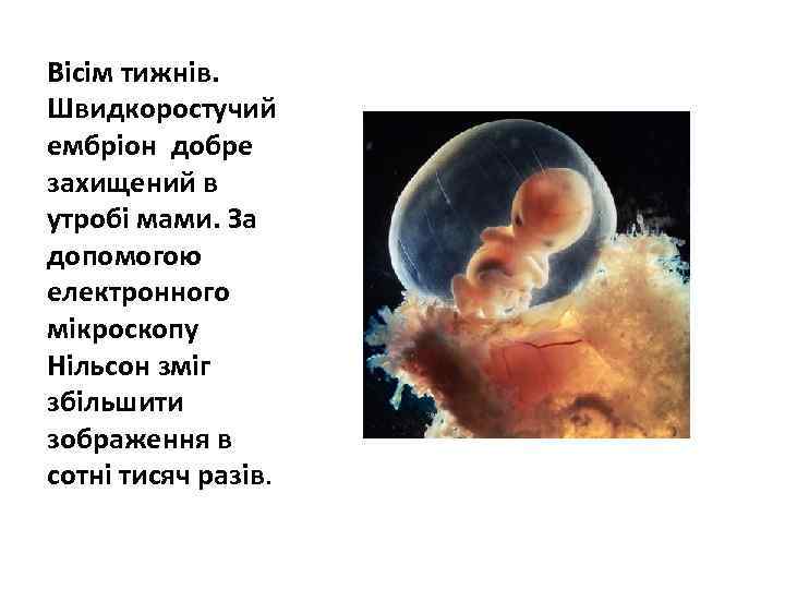 Вісім тижнів. Швидкоростучий ембріон добре захищений в утробі мами. За допомогою електронного мікроскопу Нільсон