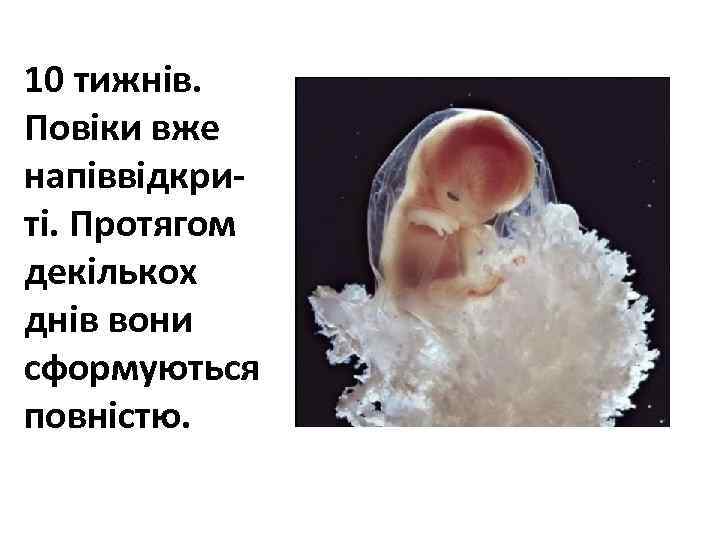 10 тижнів. Повіки вже напіввідкриті. Протягом декількох днів вони сформуються повністю. 