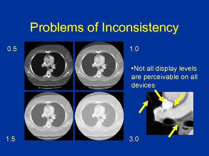 Problems of Inconsistency 0. 5 1. 0 • Not all display levels are perceivable