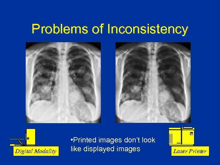 Problems of Inconsistency Digital Modality • Printed images don’t look like displayed images Laser