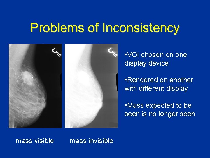 Problems of Inconsistency • VOI chosen on one display device • Rendered on another