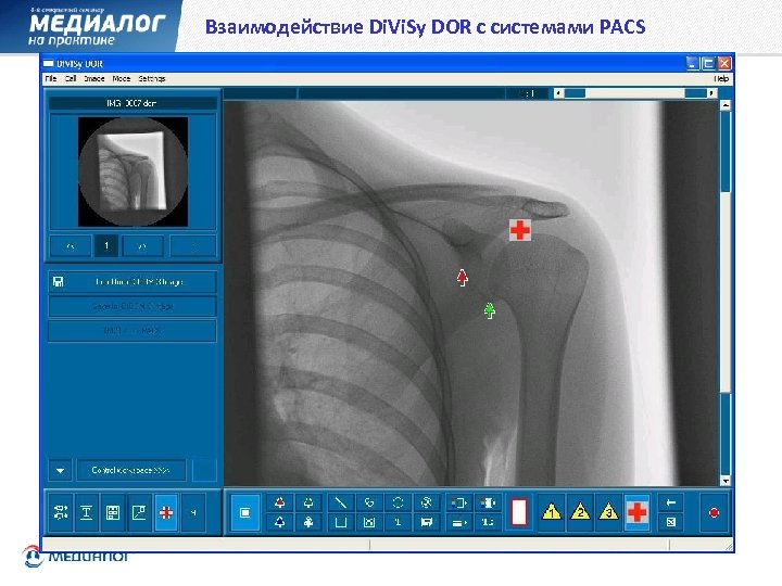 Взаимодействие Di. Vi. Sy DOR с системами PACS 