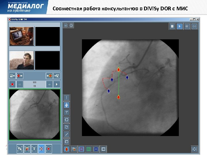 Совместная работа консультантов в Di. Vi. Sy DOR с МИС 
