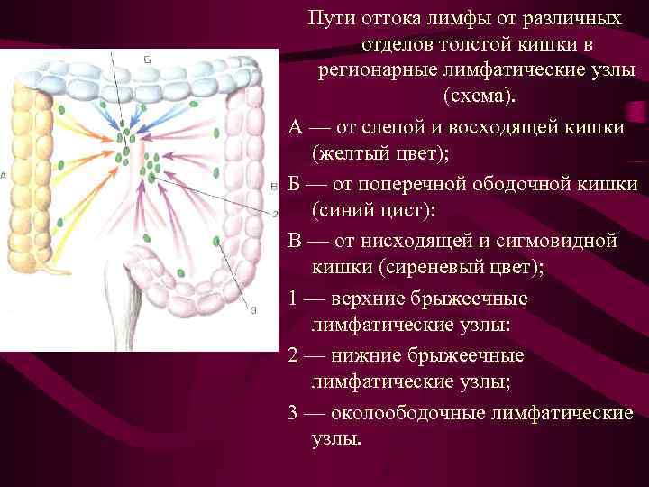 Пути оттока лимфы от различных отделов толстой кишки в регионарные лимфатические узлы (схема). А