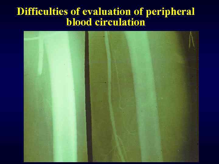 Difficulties of evaluation of peripheral blood circulation 