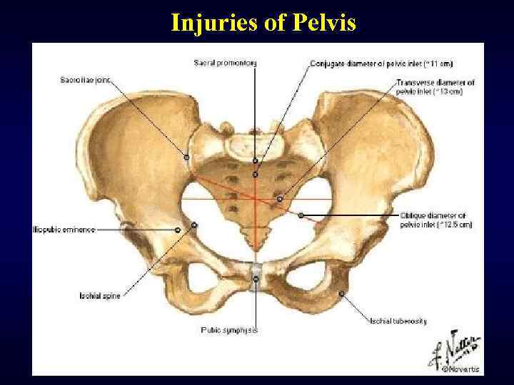 Injuries of Pelvis 