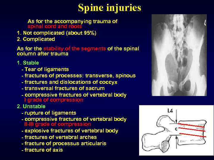 Spine injuries As for the accompanying trauma of spinal cord and roots 1. Not