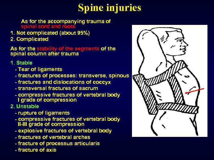 Spine injuries As for the accompanying trauma of spinal cord and roots 1. Not