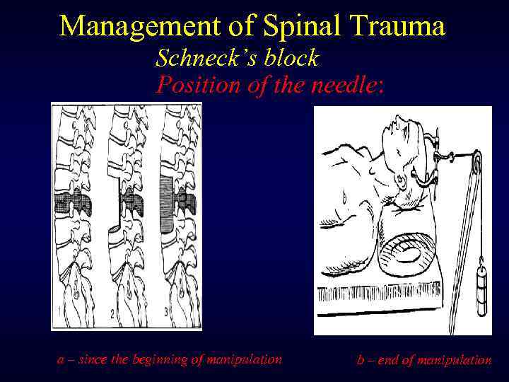 Management of Spinal Trauma Schneck’s block Position of the needle: a – since the