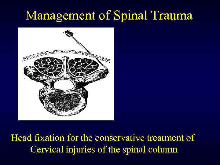 Management of Spinal Trauma Head fixation for the conservative treatment of Cervical injuries of