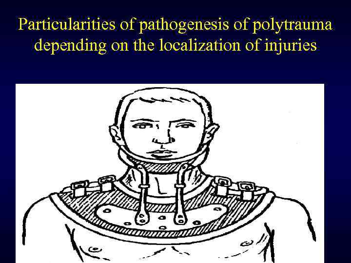 Particularities of pathogenesis of polytrauma depending on the localization of injuries 