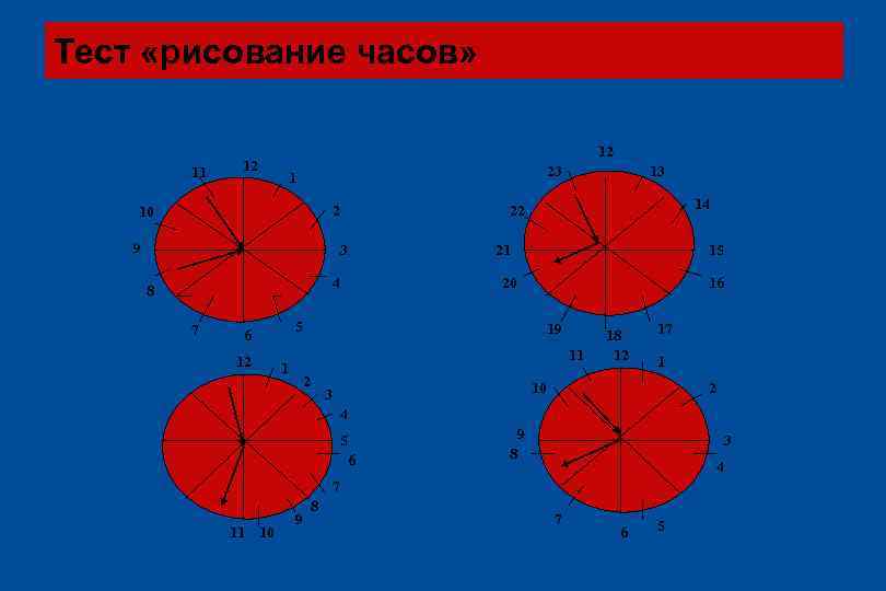 Тест «рисование часов» 11 12 12 23 1 2 10 9 3 4 8