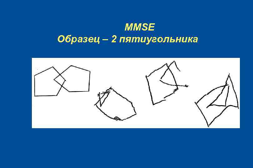 MMSE Образец – 2 пятиугольника 