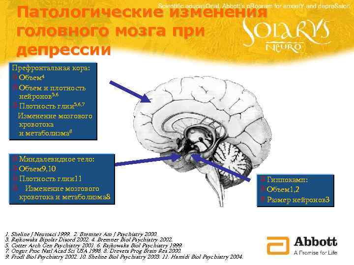 Патологические изменения головного мозга при депрессии Префронтальная кора: ò Объем 4 ò Объем и