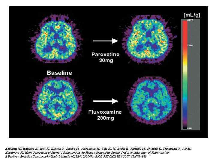 Ishikawa M. , Ishiwata K. , Ishii K. , Kimura Y. , Sakata M.