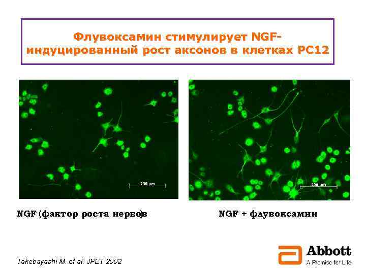 Флувоксамин стимулирует NGFиндуцированный рост аксонов в клетках PC 12 NGF (фактор роста нервов )