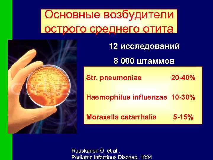 Основные возбудители острого среднего отита 12 исследований 8 000 штаммов Str. pneumoniaе 20 -40%