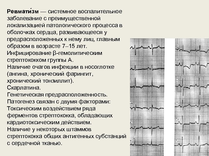 Ревмати зм — системное воспалительное заболевание с преимущественной локализацией патологического процесса в оболочках сердца,