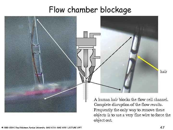 Flow chamber blockage hair A human hair blocks the flow cell channel. Complete disruption