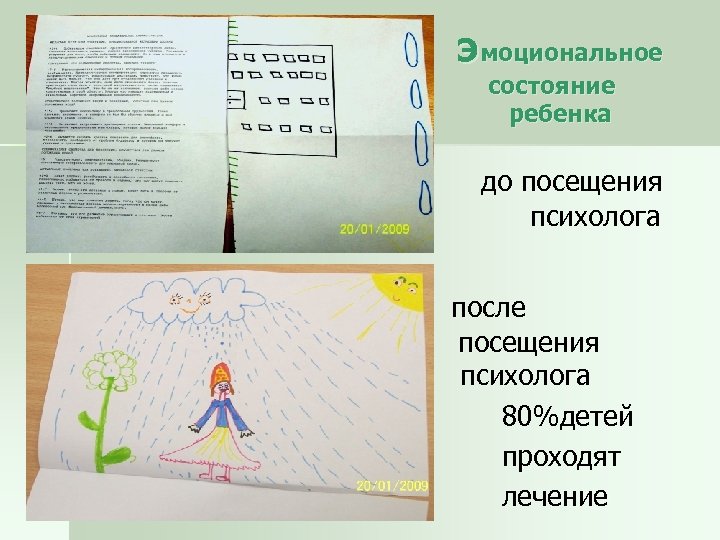  э моциональное состояние ребенка до посещения психолога после посещения психолога 80%детей проходят лечение