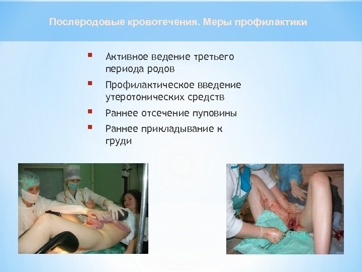 Послеродовые кровотечения. Меры профилактики § Активное ведение третьего периода родов § Профилактическое введение утеротонических