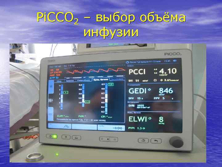 Pi. CCO 2 – выбор объёма инфузии 