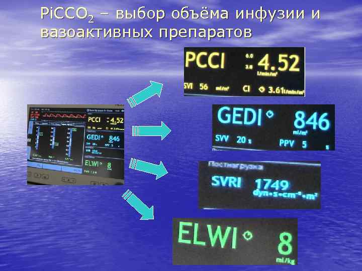 Pi. CCO 2 – выбор объёма инфузии и вазоактивных препаратов 