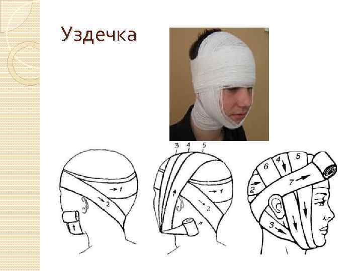 Уздечка 