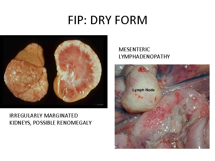 FIP: DRY FORM MESENTERIC LYMPHADENOPATHY IRREGULARLY MARGINATED KIDNEYS, POSSIBLE RENOMEGALY 