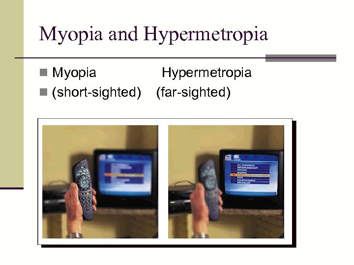 Myopia and Hypermetropia n Myopia n (short-sighted) Hypermetropia (far-sighted) 