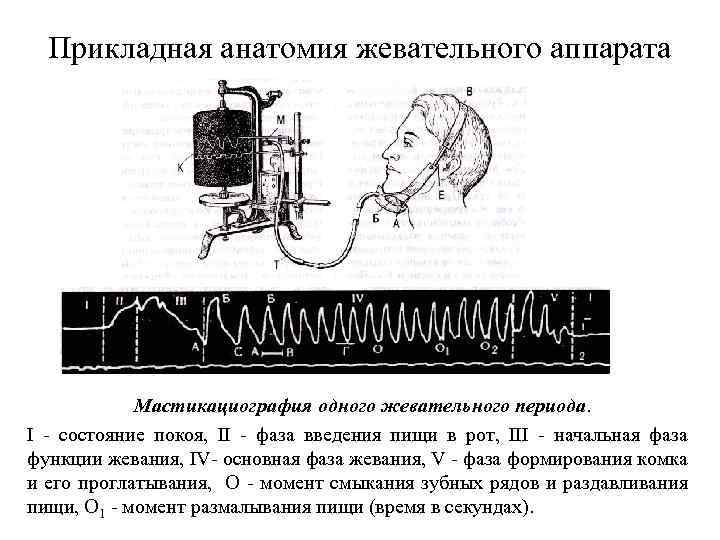 Прикладная анатомия жевательного аппарата Мастикациография одного жевательного периода. I - состояние покоя, II -