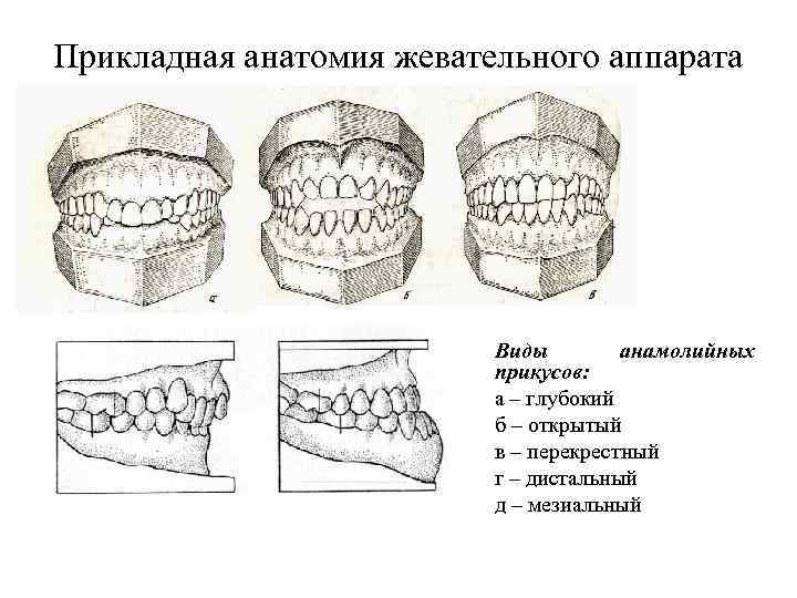 Перекрестный прикус это