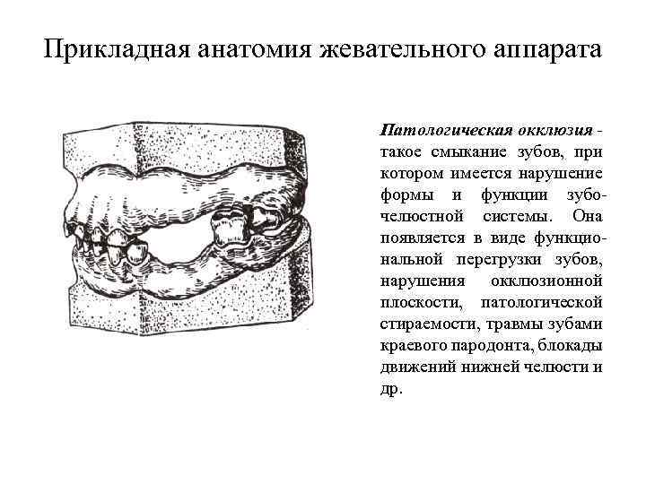 Прикладная анатомия жевательного аппарата Патологическая окклюзия такое смыкание зубов, при котором имеется нарушение формы