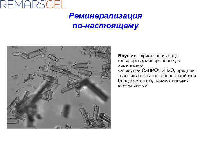 Реминерализация по-настоящему Брушит – кристалл из рода фосфорных минеральных, с химической формулой Ca. HPO