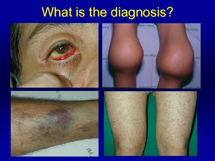 What is the diagnosis? 