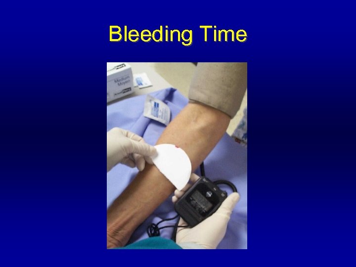 Bleeding Time 