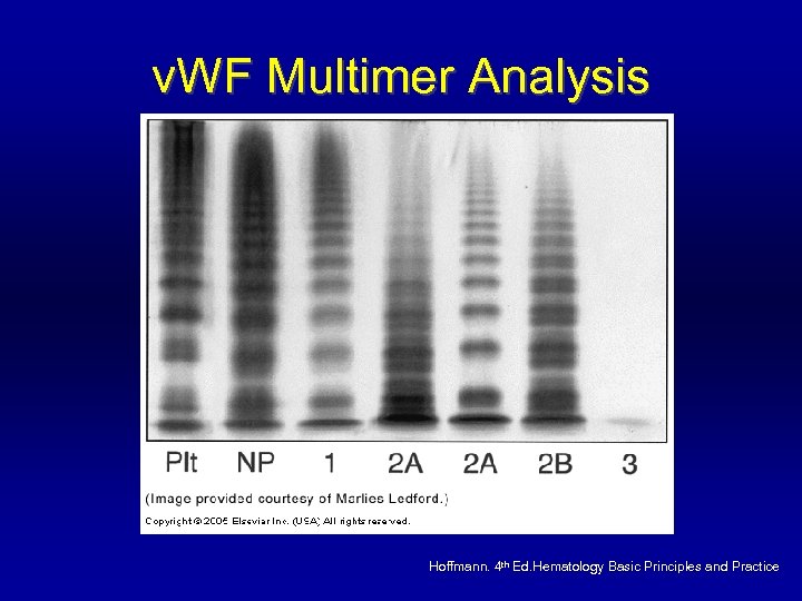v. WF Multimer Analysis Hoffmann. 4 th Ed. Hematology Basic Principles and Practice 