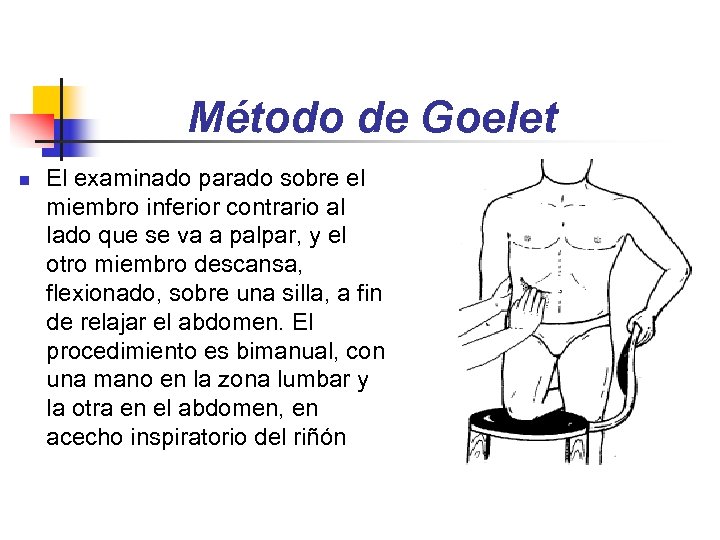 Método de Goelet n El examinado parado sobre el miembro inferior contrario al lado