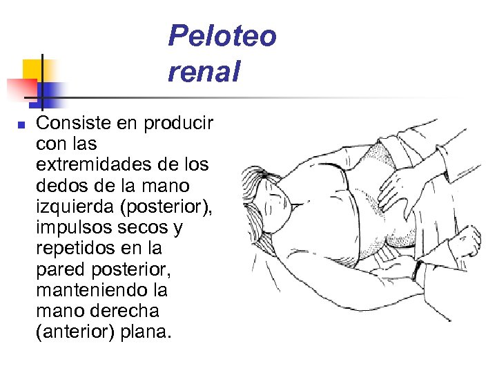 Peloteo renal n Consiste en producir con las extremidades de los dedos de la