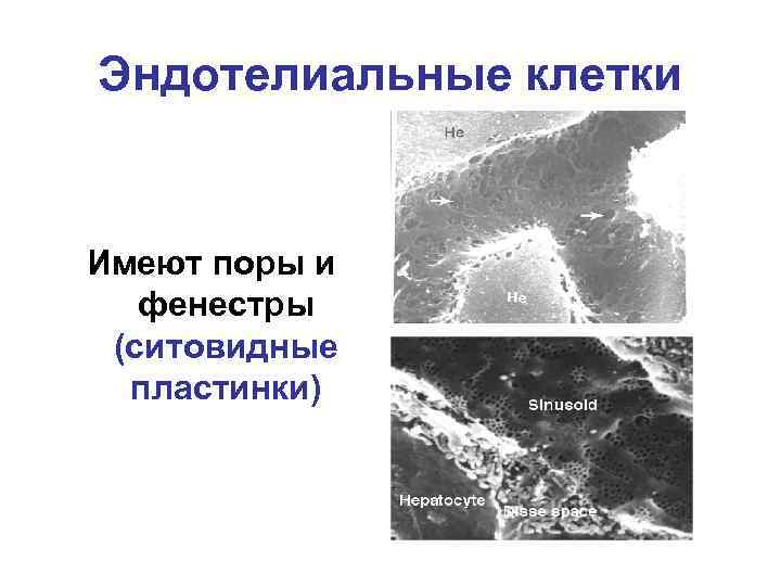 Эндотелиальные клетки Имеют поры и фенестры (ситовидные пластинки) 