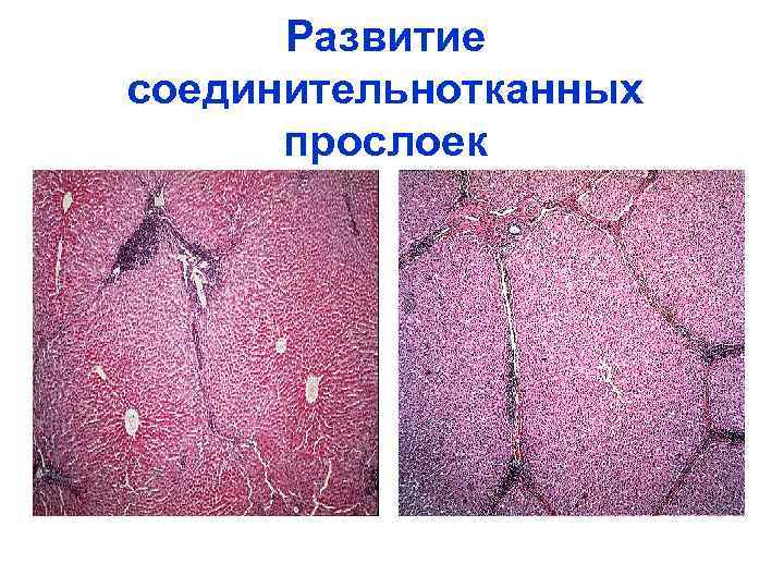 Развитие соединительнотканных прослоек 