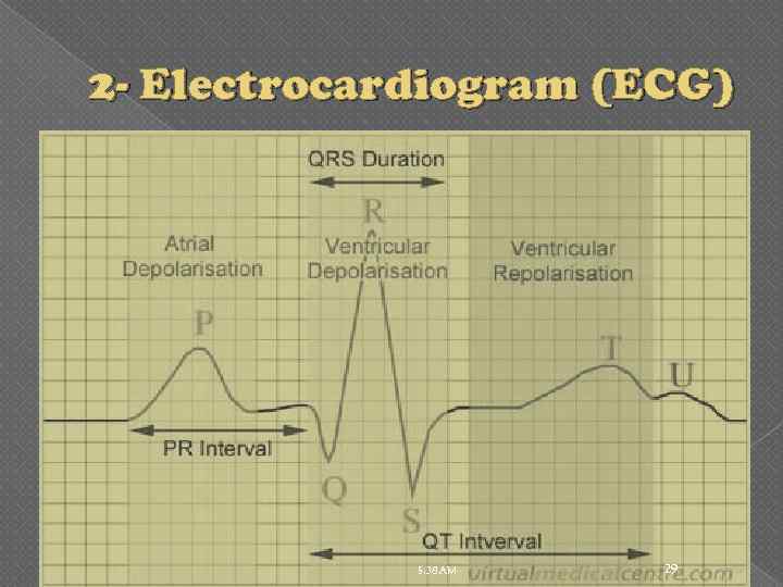 2 - Electrocardiogram (ECG) 5: 38 AM 29 