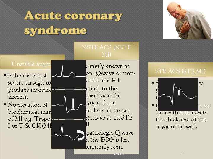 Acute coronary syndrome NSTE ACS (NSTE MI) Unstable angina • Ischemia is not severe